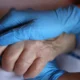 Um a cada cinco idosos internados por gripe morreu no ano passado