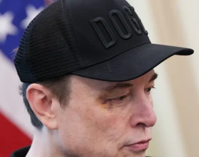 "Disse para me dar soco e ele deu": olho roxo de Musk chama a atenção