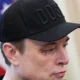 "Disse para me dar soco e ele deu": olho roxo de Musk chama a atenção