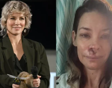 Evangeline Lilly, estrela de 'Lost', sofre acidente na praia