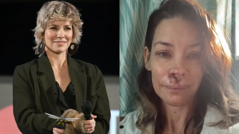 Evangeline Lilly, estrela de 'Lost', sofre acidente na praia