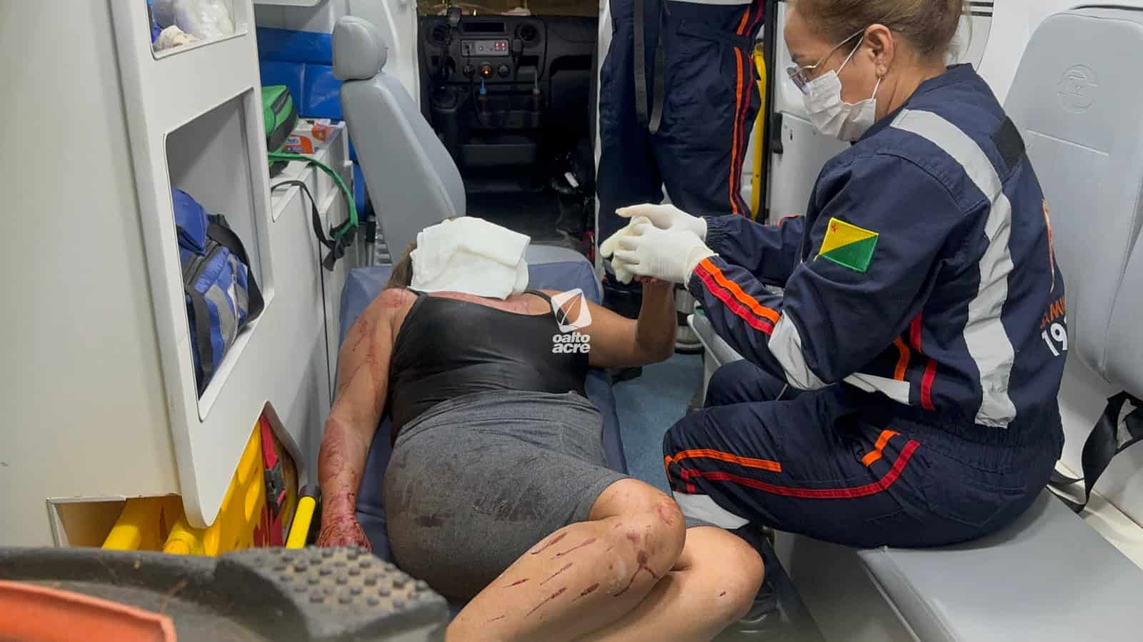 Homem Invade Casa E Tenta Matar Ex-companheira A Facadas Enquanto Ela Dormia