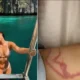 Influencer é picada por espécie de água-viva "mais venenosa" do mundo