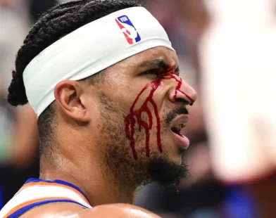 Jogador dos New York Knicks fica sangrando após cotovelada