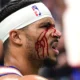 Jogador dos New York Knicks fica sangrando após cotovelada