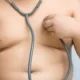 Jovem a partir dos 14 anos passa a poder fazer cirurgia bariátrica