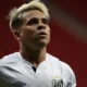 Lesões viram rotina no Santos e dificultam formação de time titular