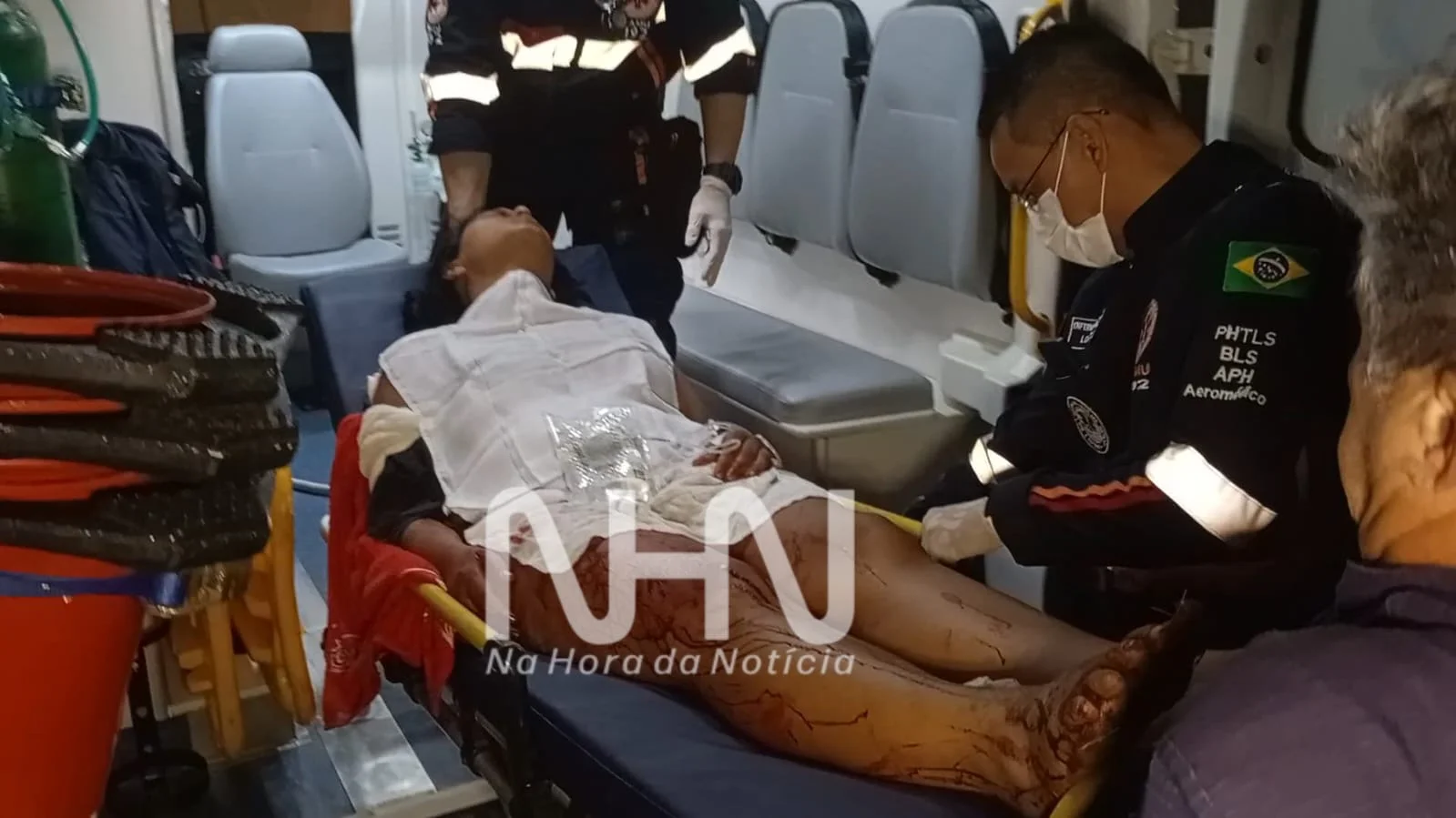 Mulher é Esfaqueada Pelo Marido
