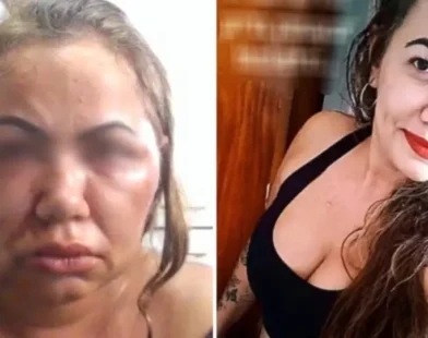 Mulher perde parte da audição após ser espancada por 2 horas por seu ex