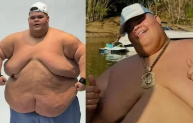 Após perder 75 kg, Gordão da XJ quer andar em elevador