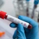 Cientistas desenvolvem nanopartículas de mRNA que podem levar à cura do HIV