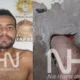 Gordinho Detento Fica Entalado Ao Tentar Fugir Do Presidio Por.webp 80x80