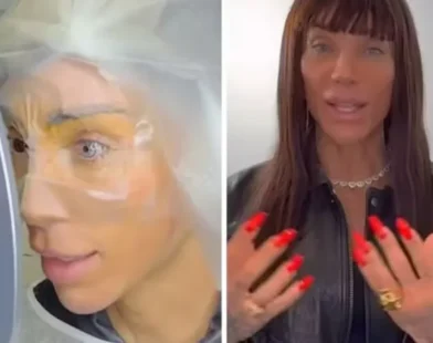 Maya Massafera faz cirurgia para mudar cor dos olhos