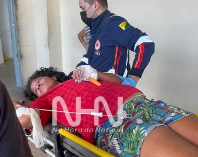 Mulher Fica Com Faca Cravada Na Mão Após Briga Com O Marido