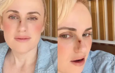 Rebel Wilson e o acidente no filme 'Bride Hard' que exigiu cirurgia