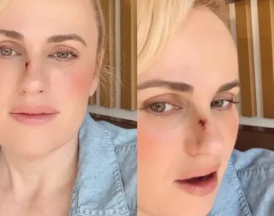 Rebel Wilson e o acidente no filme 'Bride Hard' que exigiu cirurgia