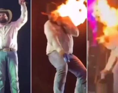 Sertanejo mostra como ficou seu rosto após ser queimado em show; vídeo